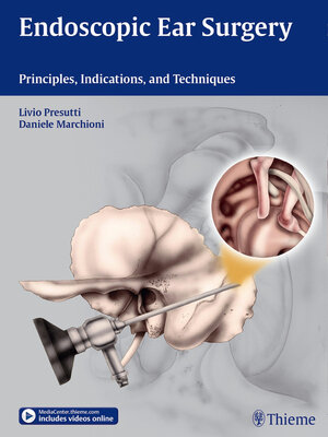 cover image of Endoscopic Ear Surgery